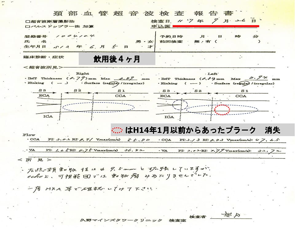 スピリチュアルモリオンレムリアンシード他合計３点アリス様専用+